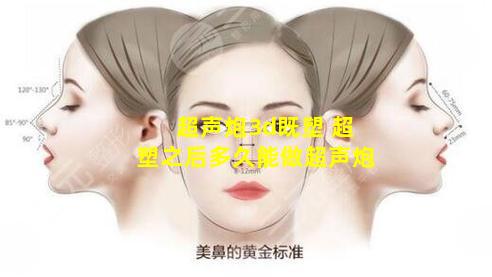 超声炮3d既塑 超塑之后多久能做超声炮